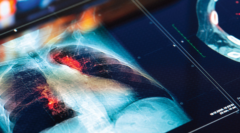 medical display showcase lung MRI